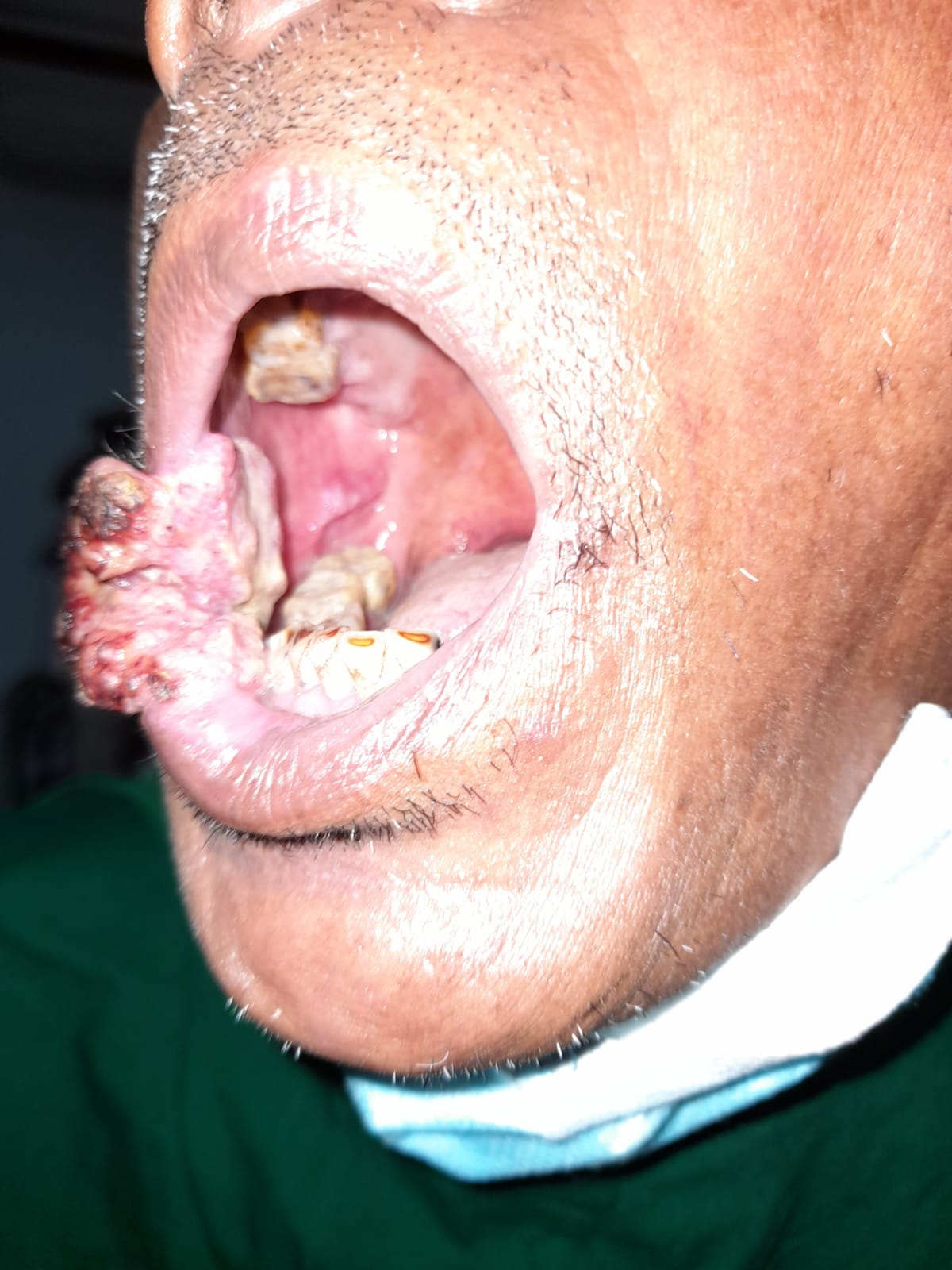 bdfd4862-298c-489c-b230-4160b5e1204a